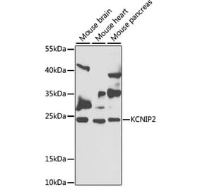 Western Blot - Anti-KChIP2 Antibody (A12073) - Antibodies.com