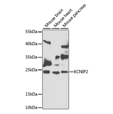 Western Blot - Anti-KChIP2 Antibody (A12073) - Antibodies.com