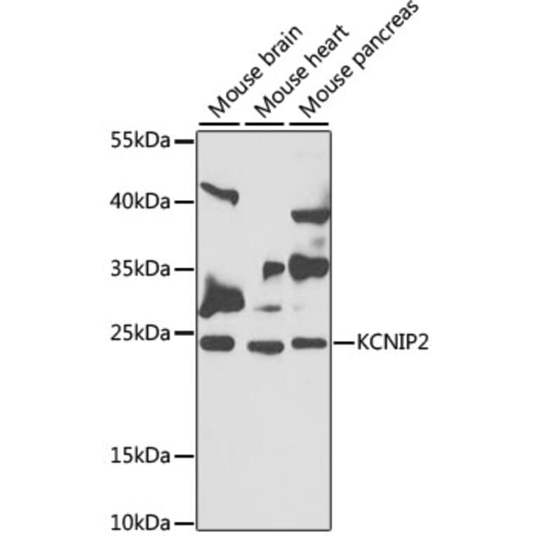 Western Blot - Anti-KChIP2 Antibody (A12073) - Antibodies.com