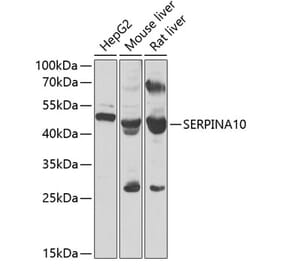 Western Blot - Anti-ZPI Antibody (A12074) - Antibodies.com