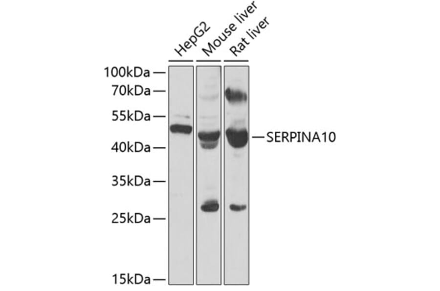 Western Blot - Anti-ZPI Antibody (A12074) - Antibodies.com