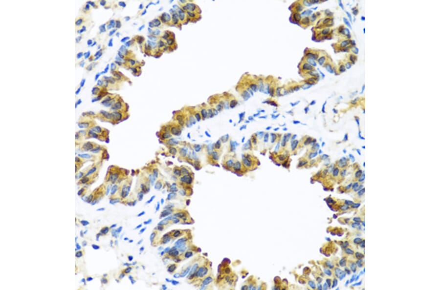 Immunohistochemistry - Anti-ZPI Antibody (A12074) - Antibodies.com