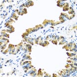 Immunohistochemistry - Anti-ZPI Antibody (A12074) - Antibodies.com