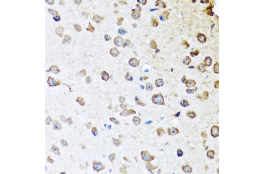 Immunohistochemistry - Anti-ZPI Antibody (A12074) - Antibodies.com
