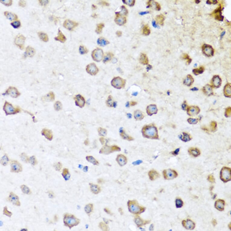 Immunohistochemistry - Anti-ZPI Antibody (A12074) - Antibodies.com