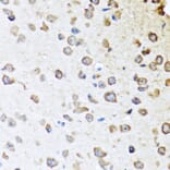 Immunohistochemistry - Anti-ZPI Antibody (A12074) - Antibodies.com