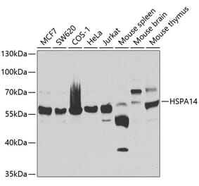 Western Blot - Anti-HSPA14 Antibody (A7107) - Antibodies.com