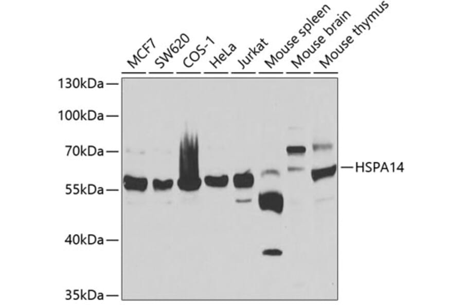 Western Blot - Anti-HSPA14 Antibody (A7107) - Antibodies.com