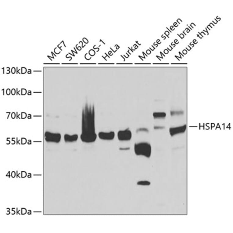 Western Blot - Anti-HSPA14 Antibody (A7107) - Antibodies.com