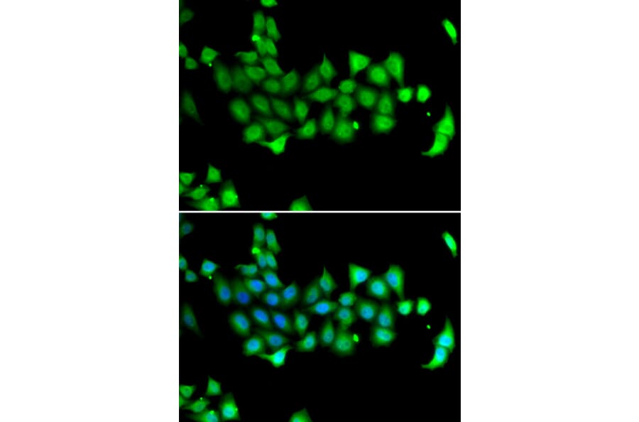 Immunofluorescence - Anti-HSPA14 Antibody (A7107) - Antibodies.com