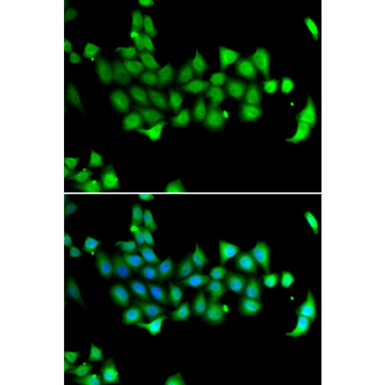 Immunofluorescence - Anti-HSPA14 Antibody (A7107) - Antibodies.com