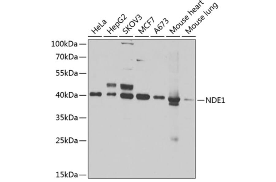 Western Blot - Anti-NDE1 Antibody (A12076) - Antibodies.com