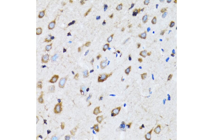 Immunohistochemistry - Anti-NDE1 Antibody (A12076) - Antibodies.com