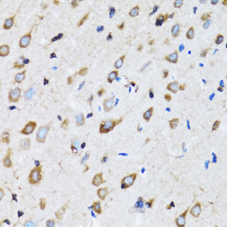 Immunohistochemistry - Anti-NDE1 Antibody (A12076) - Antibodies.com