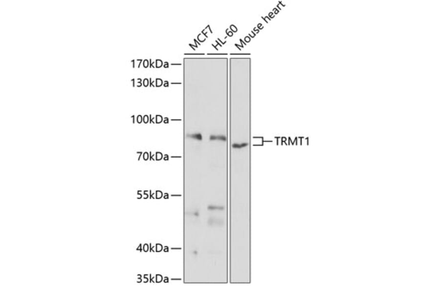 Western Blot - Anti-TRM1 Antibody (A12077) - Antibodies.com