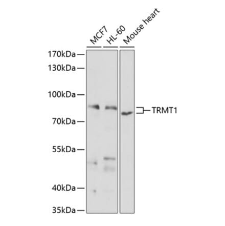 Western Blot - Anti-TRM1 Antibody (A12077) - Antibodies.com