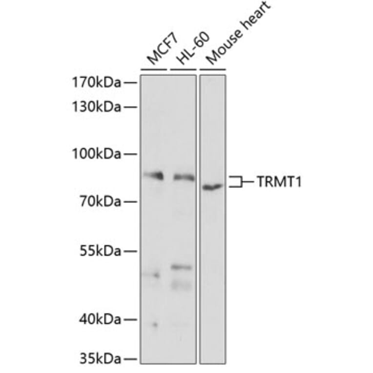 Western Blot - Anti-TRM1 Antibody (A12077) - Antibodies.com