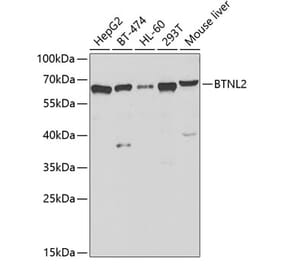 Western Blot - Anti-BTNL2 Antibody (A12078) - Antibodies.com