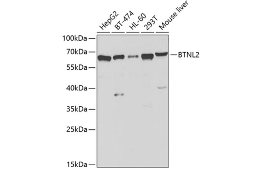 Western Blot - Anti-BTNL2 Antibody (A12078) - Antibodies.com