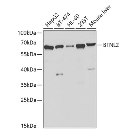 Western Blot - Anti-BTNL2 Antibody (A12078) - Antibodies.com