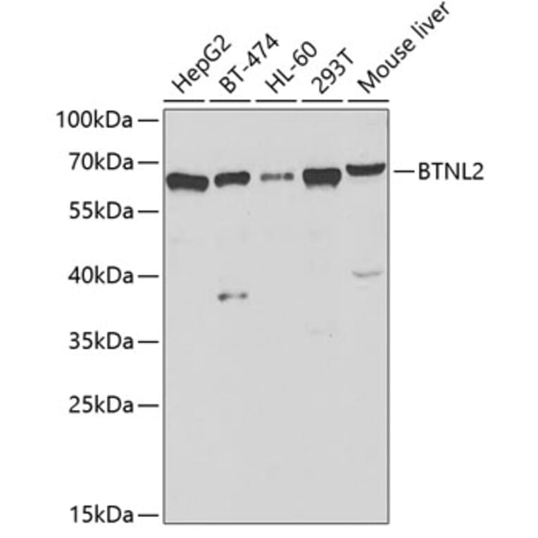 Western Blot - Anti-BTNL2 Antibody (A12078) - Antibodies.com