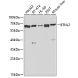 Western Blot - Anti-BTNL2 Antibody (A12078) - Antibodies.com