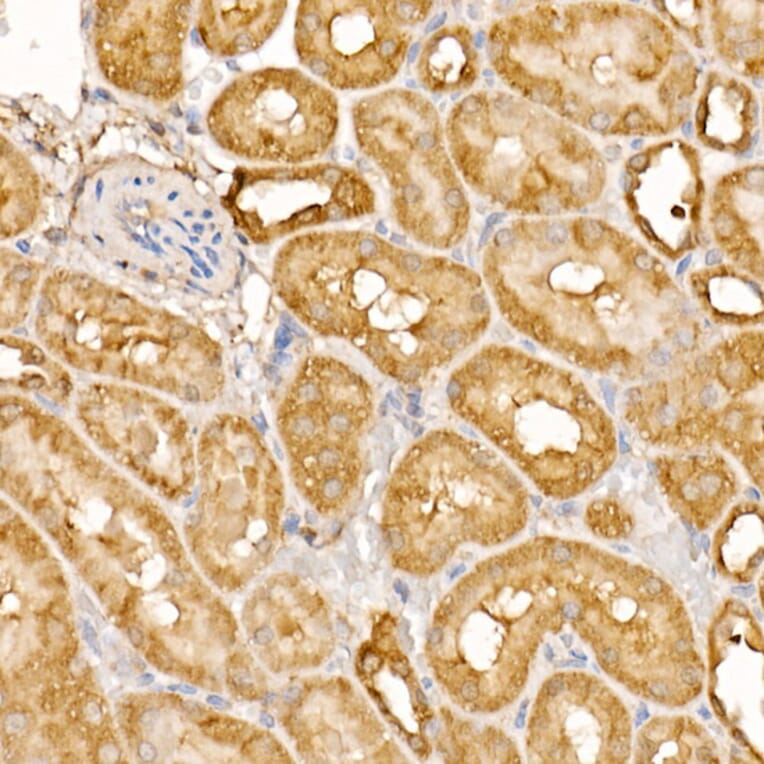 Immunohistochemistry - Anti-BTNL2 Antibody (A12078) - Antibodies.com