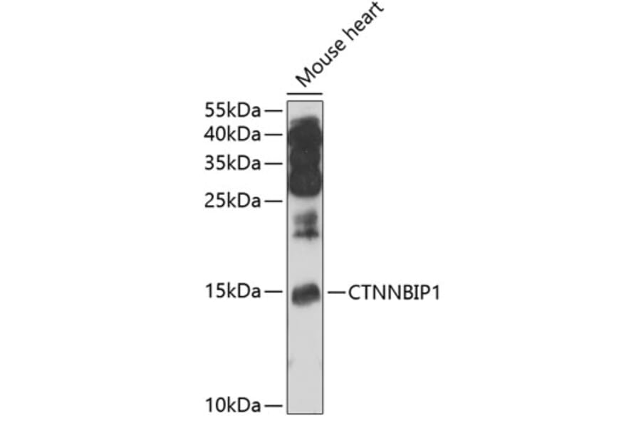 Western Blot - Anti-CTNNBIP1/ICAT Antibody (A12079) - Antibodies.com
