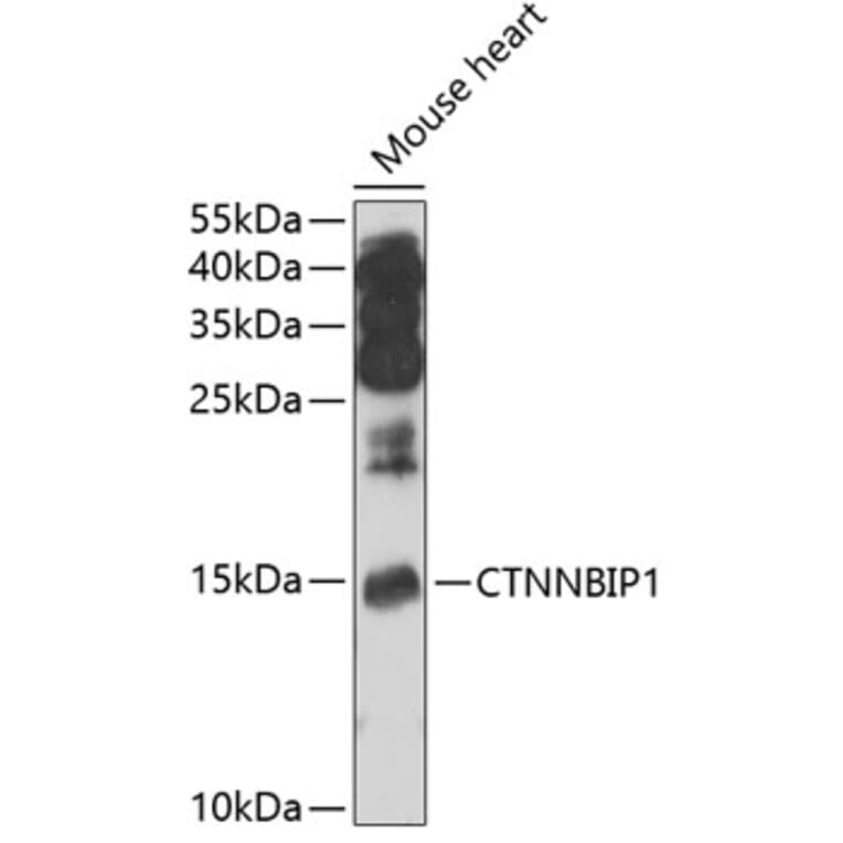 Western Blot - Anti-CTNNBIP1/ICAT Antibody (A12079) - Antibodies.com