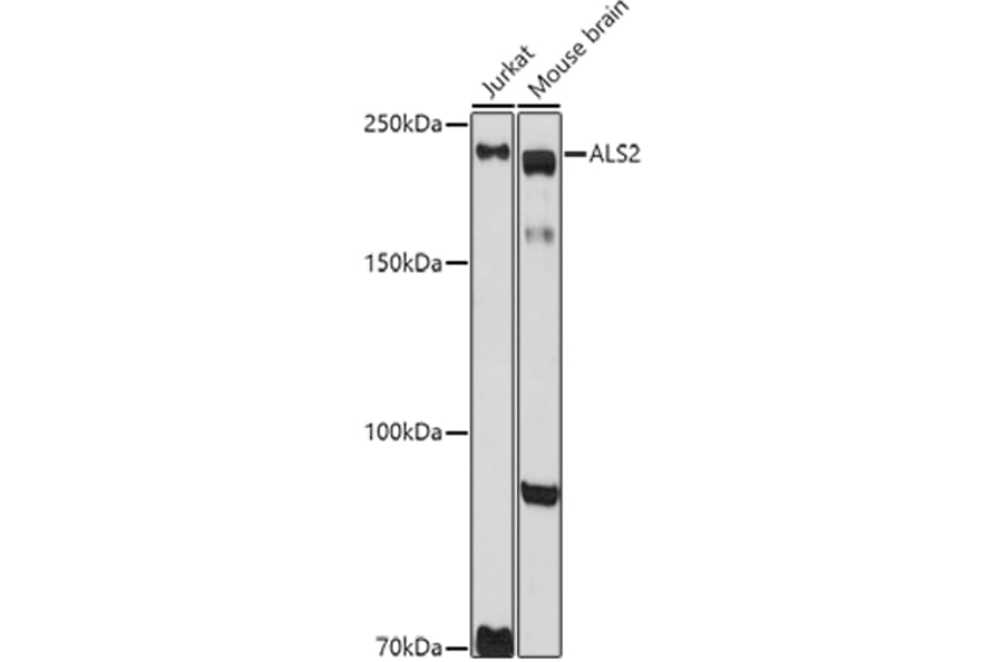 Western Blot - Anti-Als2 Antibody (A12080) - Antibodies.com