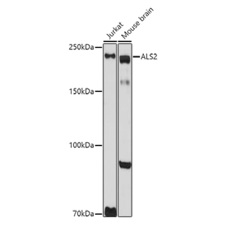Western Blot - Anti-Als2 Antibody (A12080) - Antibodies.com