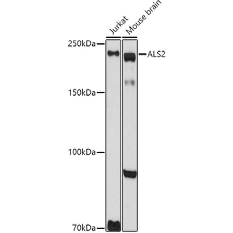 Western Blot - Anti-Als2 Antibody (A12080) - Antibodies.com