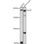 Western Blot - Anti-Als2 Antibody (A12080) - Antibodies.com