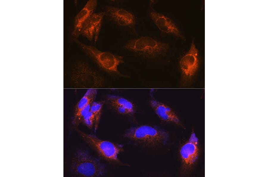 Immunofluorescence - Anti-Als2 Antibody (A12080) - Antibodies.com