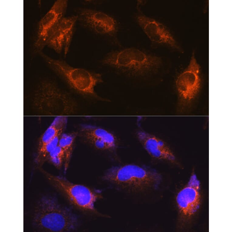Immunofluorescence - Anti-Als2 Antibody (A12080) - Antibodies.com