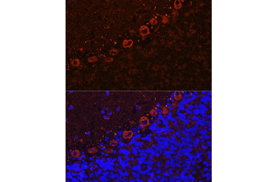 Immunofluorescence - Anti-Als2 Antibody (A12080) - Antibodies.com