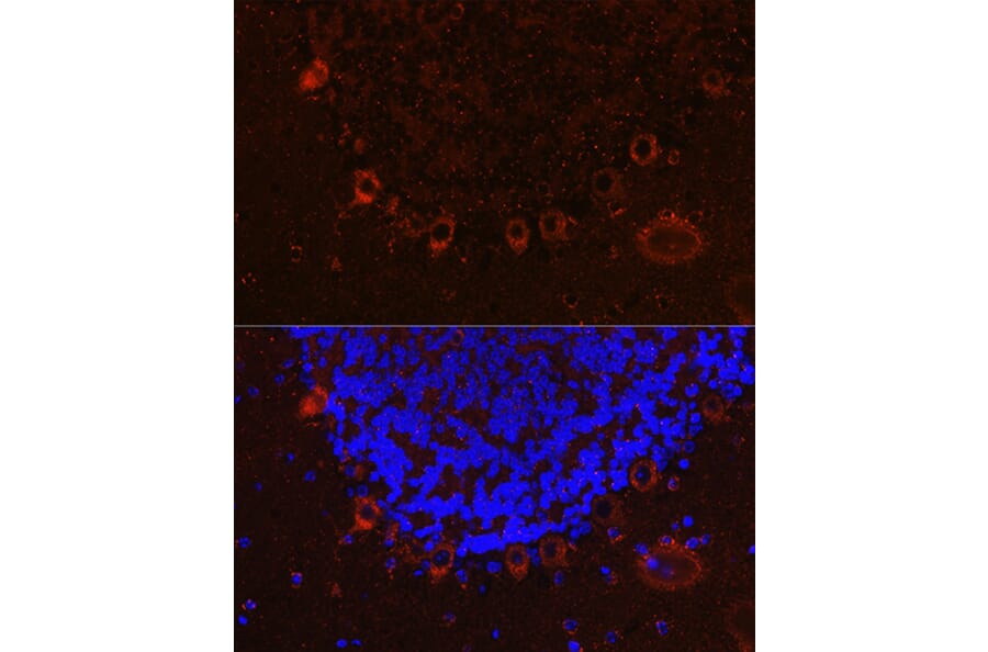 Immunofluorescence - Anti-Als2 Antibody (A12080) - Antibodies.com