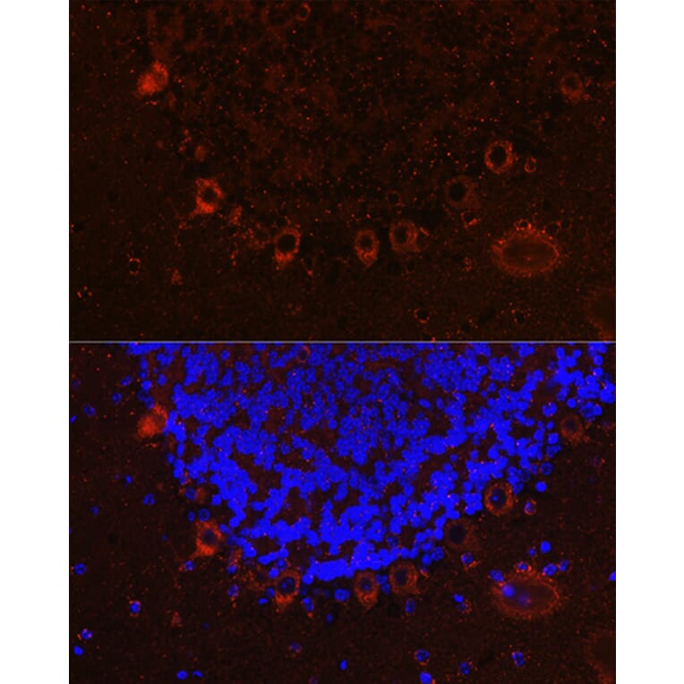 Immunofluorescence - Anti-Als2 Antibody (A12080) - Antibodies.com