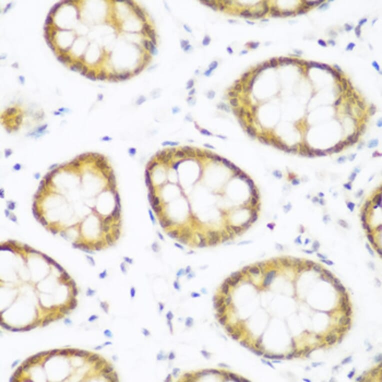 Immunohistochemistry - Anti-BRD9 Antibody (A12081) - Antibodies.com