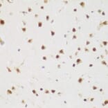 Immunohistochemistry - Anti-BRD9 Antibody (A12081) - Antibodies.com