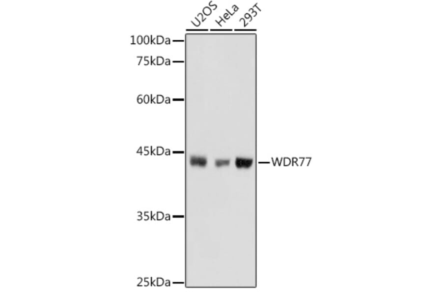 Western Blot - Anti-WDR77 Antibody (A12082) - Antibodies.com