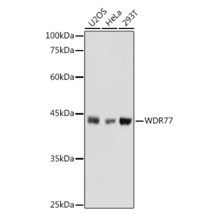 Western Blot - Anti-WDR77 Antibody (A12082) - Antibodies.com
