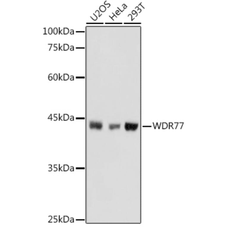 Western Blot - Anti-WDR77 Antibody (A12082) - Antibodies.com