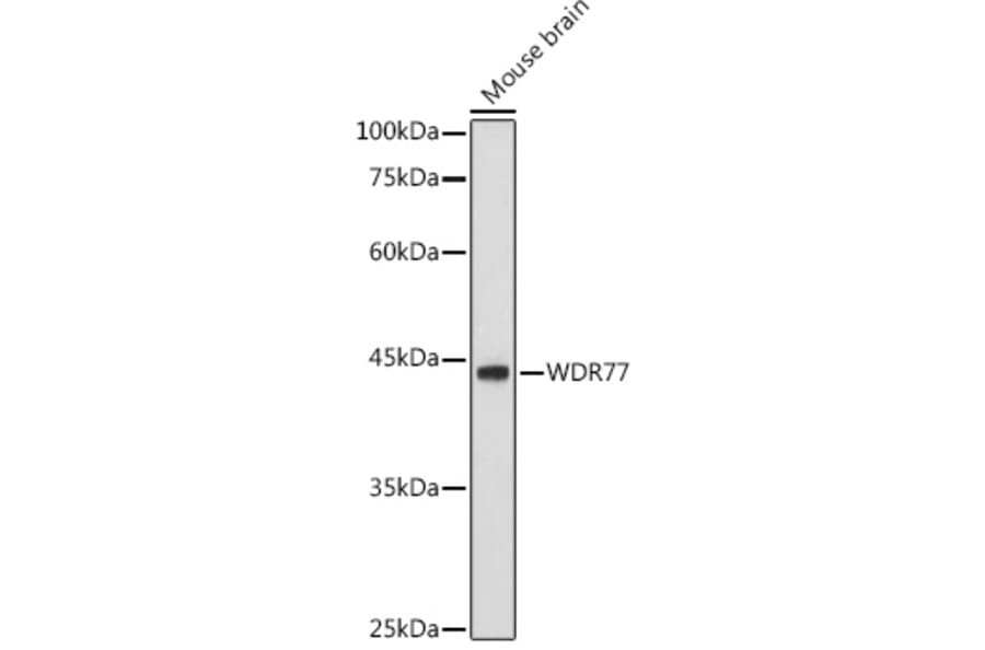 Western Blot - Anti-WDR77 Antibody (A12082) - Antibodies.com
