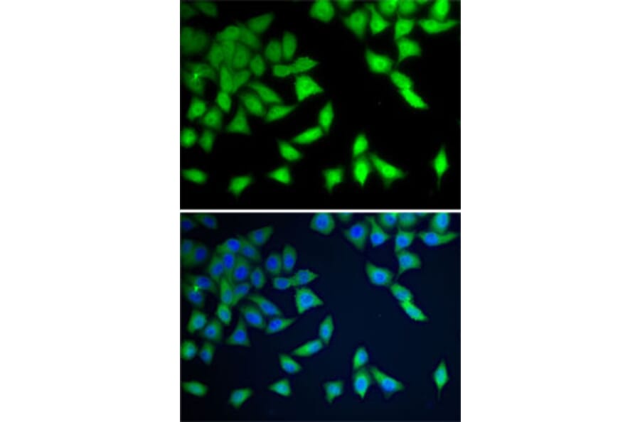 Immunofluorescence - Anti-WDR77 Antibody (A12082) - Antibodies.com
