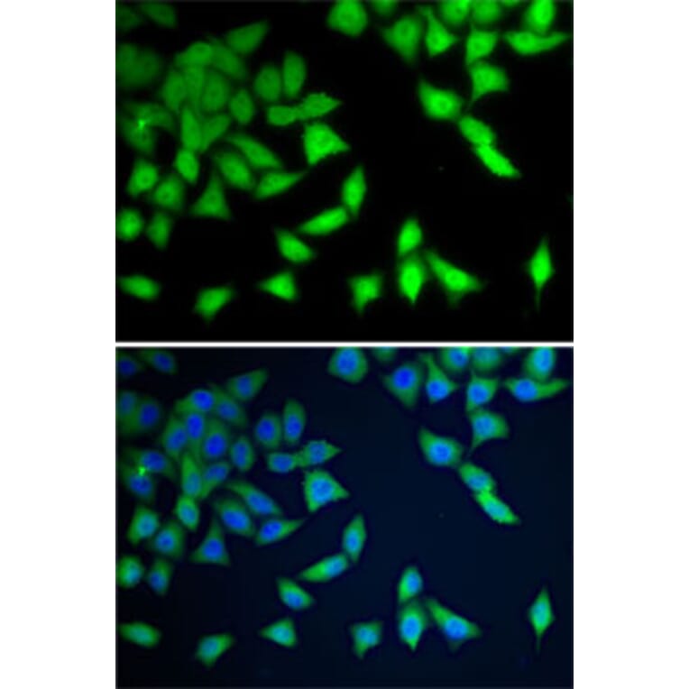 Immunofluorescence - Anti-WDR77 Antibody (A12082) - Antibodies.com