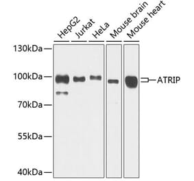 Western Blot - Anti-ATRIP Antibody (A12083) - Antibodies.com