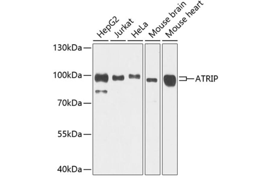 Western Blot - Anti-ATRIP Antibody (A12083) - Antibodies.com