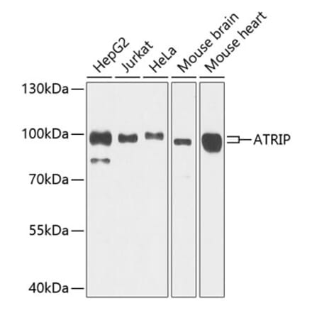 Western Blot - Anti-ATRIP Antibody (A12083) - Antibodies.com