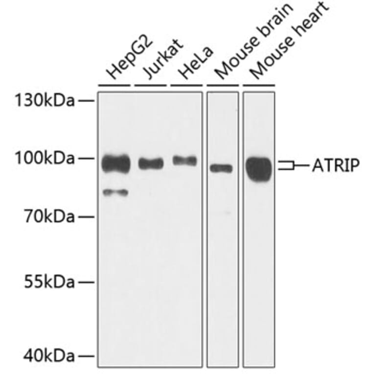 Western Blot - Anti-ATRIP Antibody (A12083) - Antibodies.com